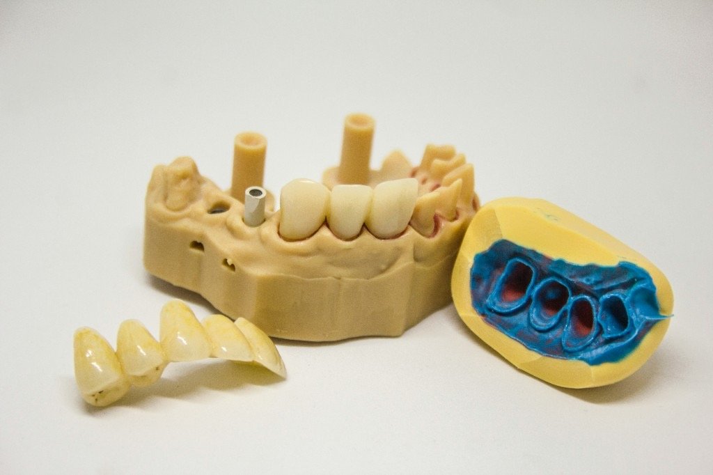 Modele dentare, urë dhe impresion për shërbime 3D laboratorike