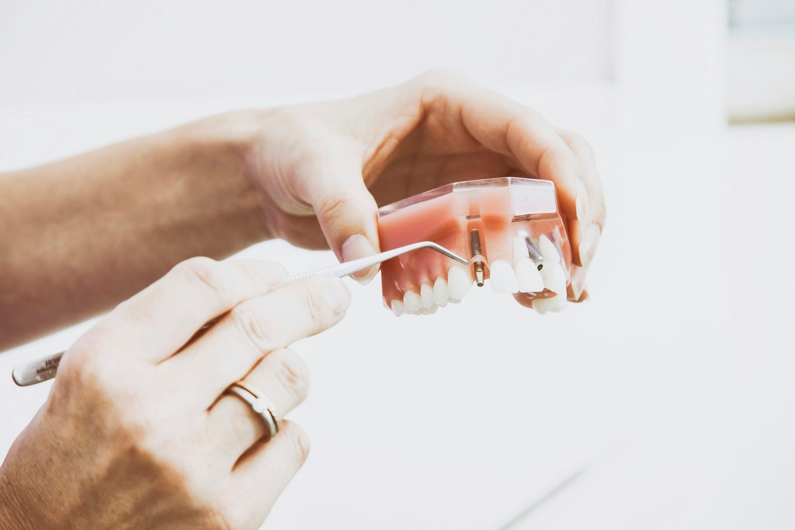 Inspektim i kujdesshëm i punës dentare të përfunduar për kontrollin e cilësisë